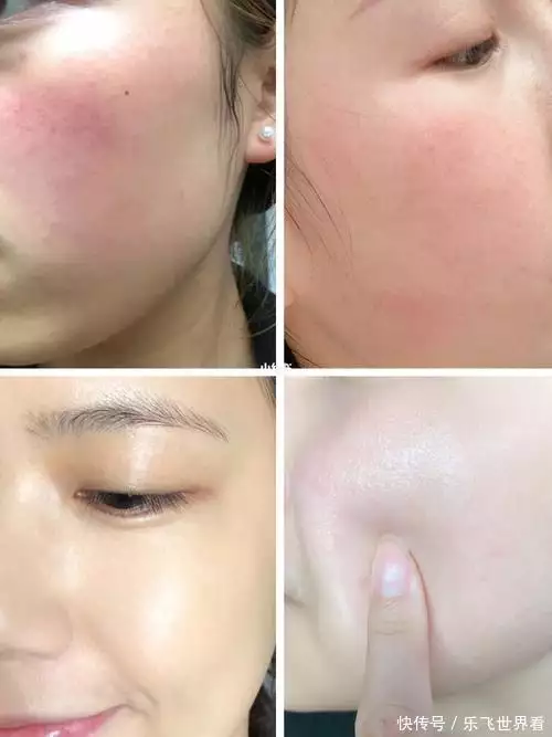 换季必备!6款保湿柔肤水,让敏感肌喝饱水!